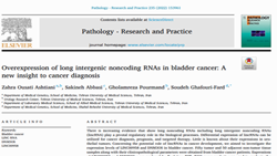 Overexpression of long intergenic noncoding RNAs in bladder cancer: A new insight to cancer diagnosis